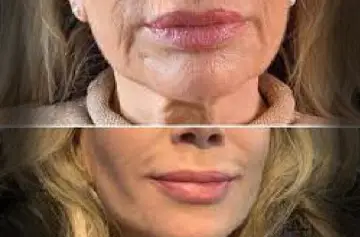 REJUVENESCIMENTO COMPLETO