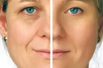 SKIN BOOSTER